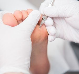 Feet for Life School of Podortho® Nursing